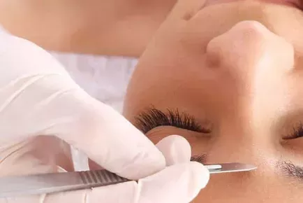 Dermaplaning